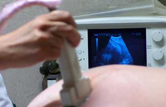 Miguel Luiz Berrettini - Foto 1